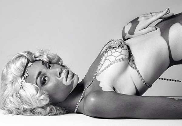 chantelle-bronw-young-vitiligo